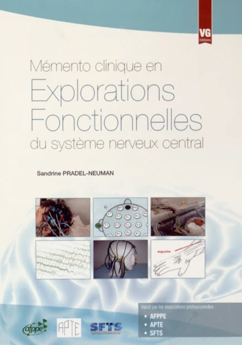 Memento clinique en explorations fonctionnelles du systeme nerveux central