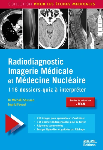 Radiodiagnostic Imagerie Medicale et Medecine Nucleaire 116 dossiers quiz a interpreter1