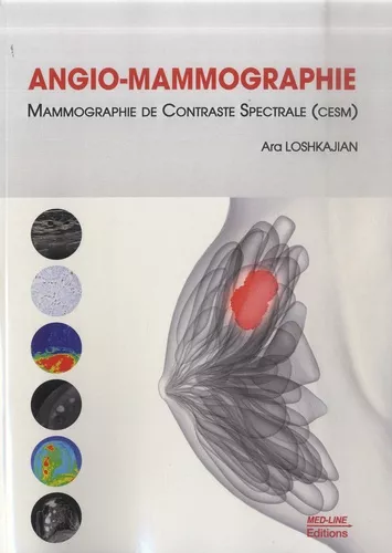 9782846782593 angio mammographie g